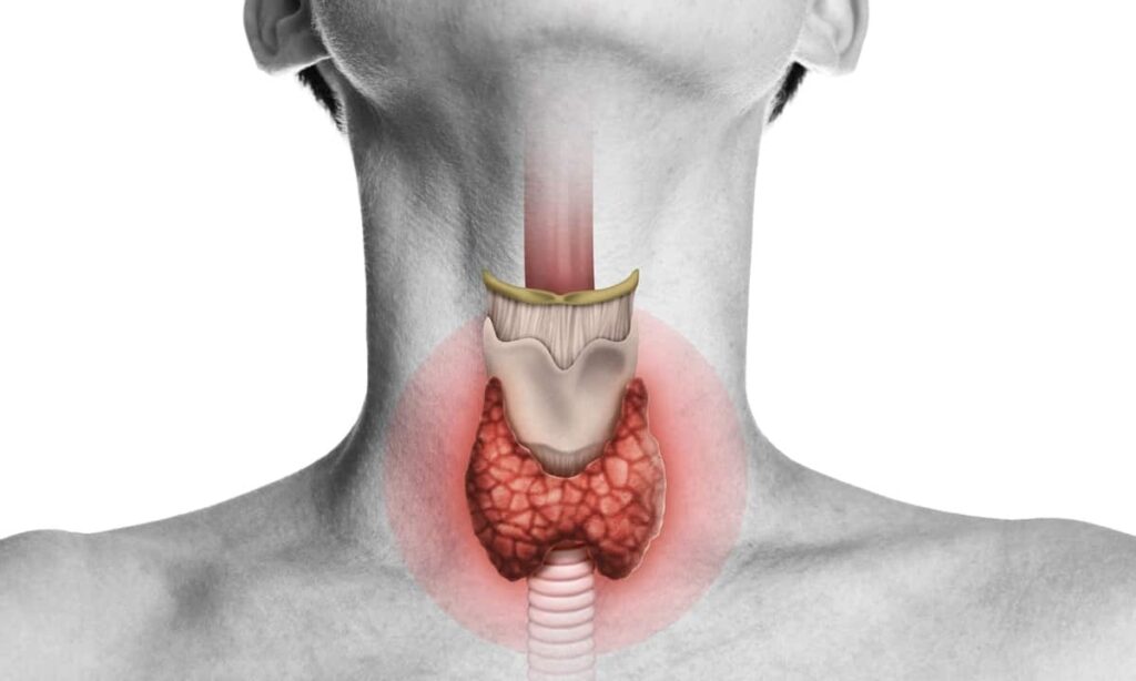 The Best Thyroid Doctor in Ahmedabad for Thyroid Disease
