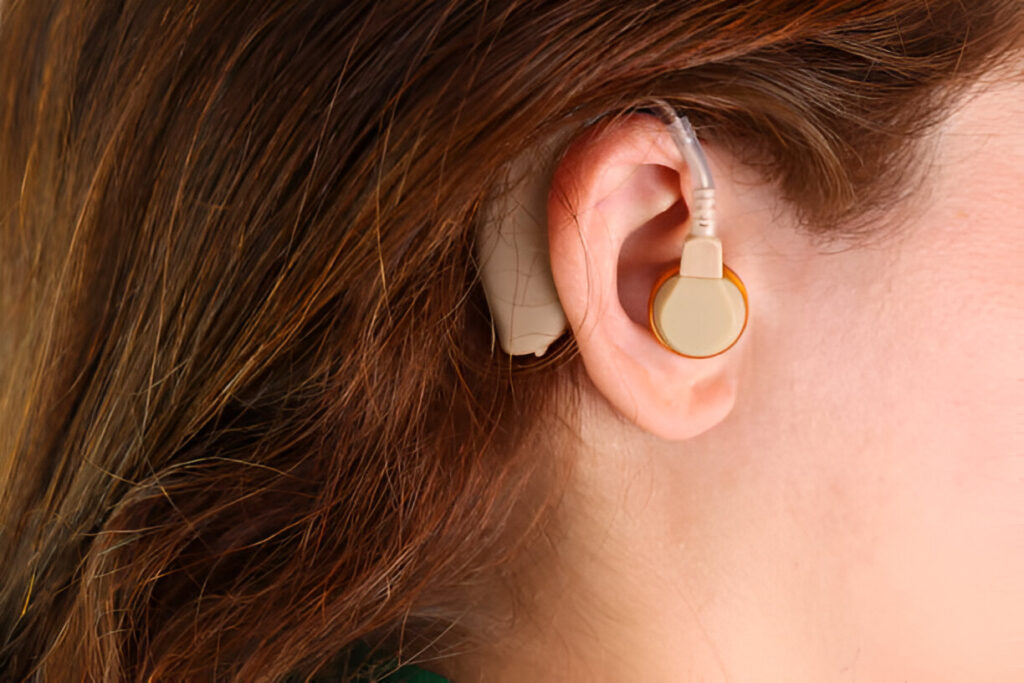 Find your Best Cochlear Implant Solutions in Ahmedabad at Evara Hospital
