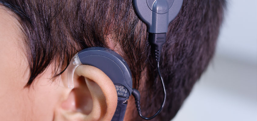 Understanding Cochlear Implant in Ahmedabad and how they can restore Hearing