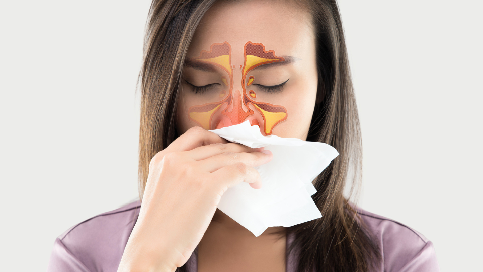 How To Treat Sinus Infection (Sinusitis) in Ahmedabad